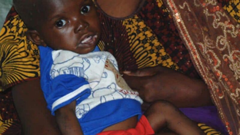 Understanding the malnutrition crisis in Mali and its health implications