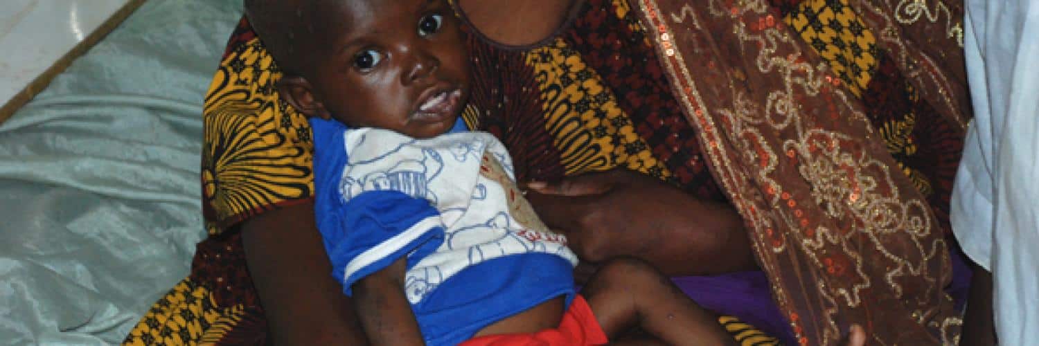 Understanding the malnutrition crisis in Mali and its health implications