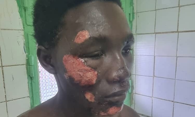 Chad security alert: father demands action after son’s assault near N’Djaména camp