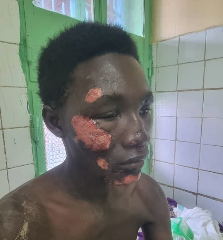 Chad security alert: father demands action after son’s assault near N’Djaména camp