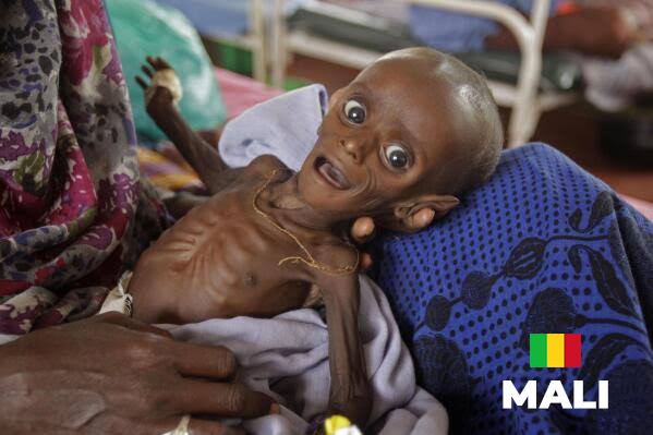 Mali’s hunger crisis: what the numbers mean for families, farms and the economy
